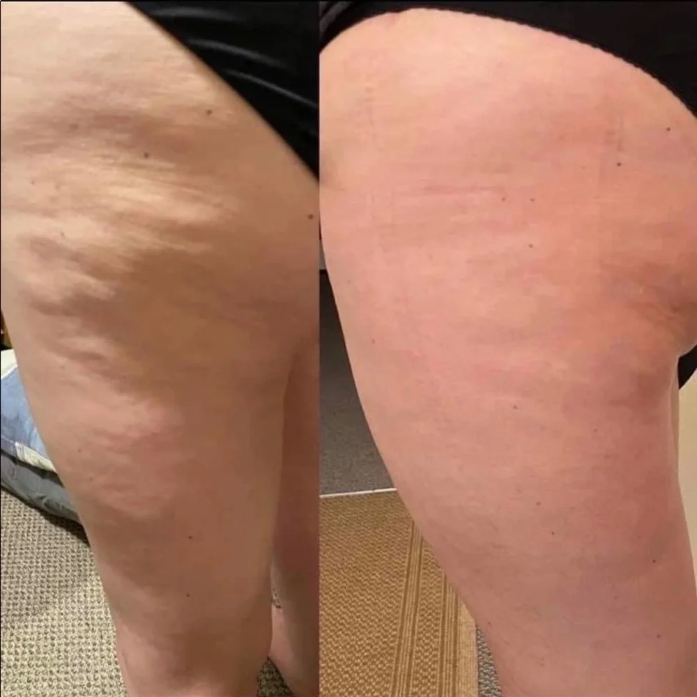 NuSkin ageLOC Dermatic Effects Firming/Cellulite Lotion - Picture 5 of 5